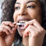 What is Invisalign