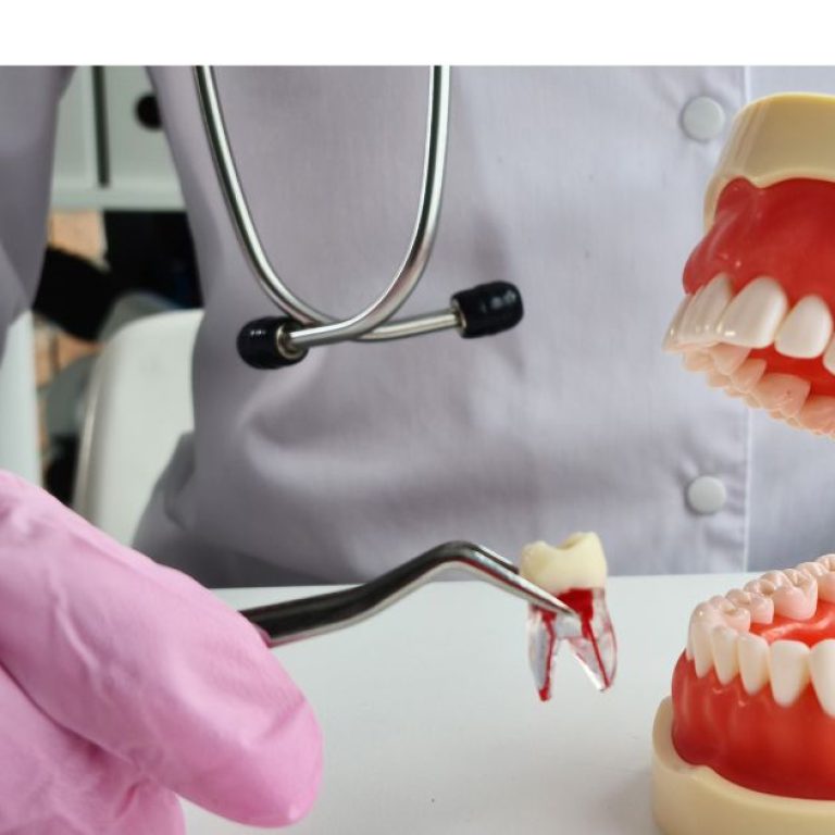 Emergency Tooth Extraction